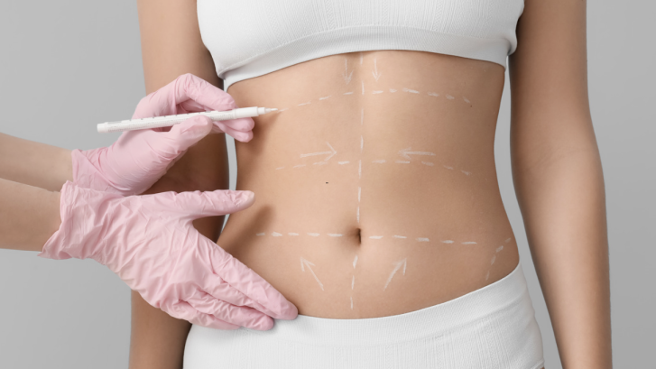 Top Plastic Surgery Services Including Liposuction Near Lexington Park MD